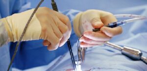 ΛΑΠΑΡΟΣΚΟΠΙΚΗ ΧΟΛΟΚΥΣΤΕΚΤΟΜΗ